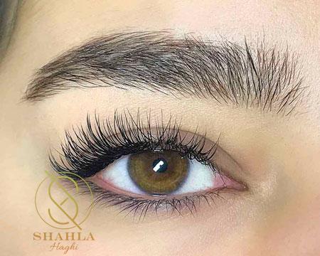 کاشت مژه کلاسیک